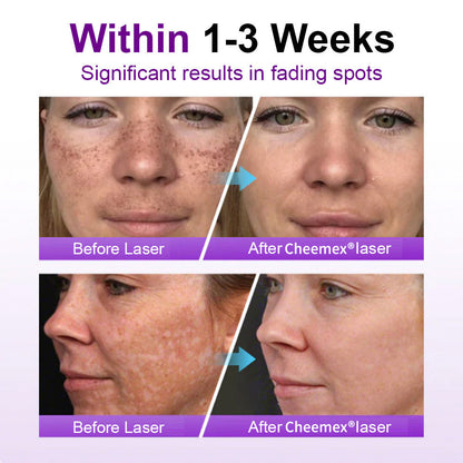 ✅𝐅𝐃𝐀-𝐀𝐏𝐏𝐑𝐎𝐕𝐄𝐃🌟Cheemex® 𝐒𝐩𝐨𝐭𝐄𝐫𝐚𝐬𝐞 𝐏𝐫𝐨𝐛𝐢𝐨𝐭𝐢𝐜 𝐒𝐡𝐢𝐞𝐥𝐝 𝐒𝐞𝐫𝐮𝐦 – Fades Dark Spots, Evens Skin Tone & Boosts Radiance✨