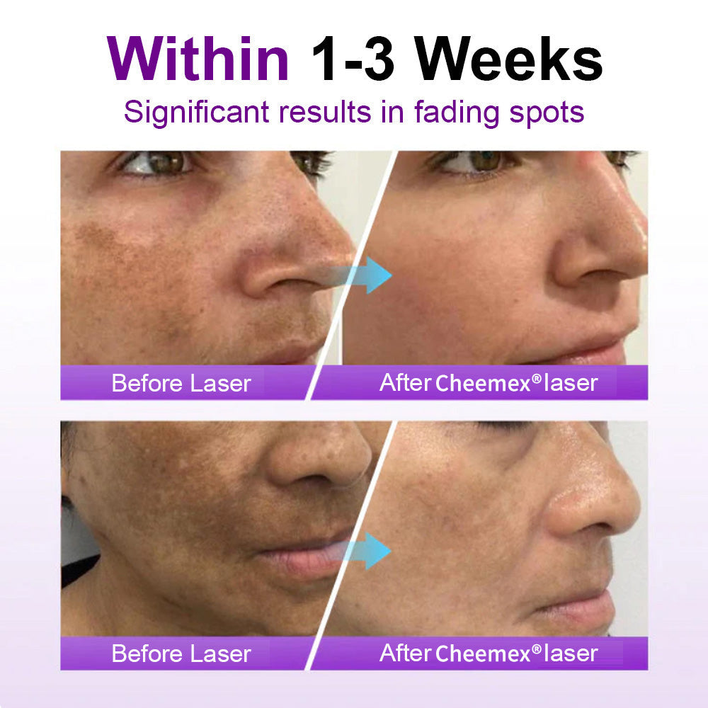 ✅𝐅𝐃𝐀-𝐀𝐏𝐏𝐑𝐎𝐕𝐄𝐃🌟Cheemex® 𝐒𝐩𝐨𝐭𝐄𝐫𝐚𝐬𝐞 𝐏𝐫𝐨𝐛𝐢𝐨𝐭𝐢𝐜 𝐒𝐡𝐢𝐞𝐥𝐝 𝐒𝐞𝐫𝐮𝐦 – Fades Dark Spots, Evens Skin Tone & Boosts Radiance✨