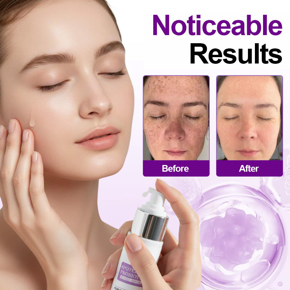 ✅𝐅𝐃𝐀-𝐀𝐏𝐏𝐑𝐎𝐕𝐄𝐃🌟Cheemex® 𝐒𝐩𝐨𝐭𝐄𝐫𝐚𝐬𝐞 𝐏𝐫𝐨𝐛𝐢𝐨𝐭𝐢𝐜 𝐒𝐡𝐢𝐞𝐥𝐝 𝐒𝐞𝐫𝐮𝐦 – Fades Dark Spots, Evens Skin Tone & Boosts Radiance✨