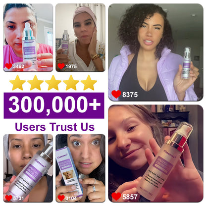 ✅𝐅𝐃𝐀-𝐀𝐏𝐏𝐑𝐎𝐕𝐄𝐃🌟Cheemex® 𝐒𝐩𝐨𝐭𝐄𝐫𝐚𝐬𝐞 𝐏𝐫𝐨𝐛𝐢𝐨𝐭𝐢𝐜 𝐒𝐡𝐢𝐞𝐥𝐝 𝐒𝐞𝐫𝐮𝐦 – Fades Dark Spots, Evens Skin Tone & Boosts Radiance✨