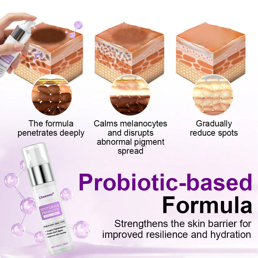 ✅𝐅𝐃𝐀-𝐀𝐏𝐏𝐑𝐎𝐕𝐄𝐃🌟Cheemex® 𝐒𝐩𝐨𝐭𝐄𝐫𝐚𝐬𝐞 𝐏𝐫𝐨𝐛𝐢𝐨𝐭𝐢𝐜 𝐒𝐡𝐢𝐞𝐥𝐝 𝐒𝐞𝐫𝐮𝐦 – Fades Dark Spots, Evens Skin Tone & Boosts Radiance✨