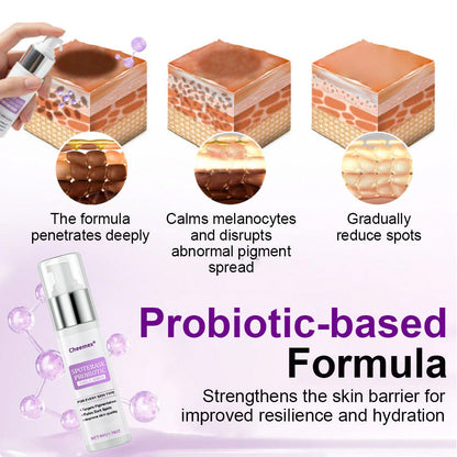 ✅𝐅𝐃𝐀-𝐀𝐏𝐏𝐑𝐎𝐕𝐄𝐃🌟Cheemex® 𝐒𝐩𝐨𝐭𝐄𝐫𝐚𝐬𝐞 𝐏𝐫𝐨𝐛𝐢𝐨𝐭𝐢𝐜 𝐒𝐡𝐢𝐞𝐥𝐝 𝐒𝐞𝐫𝐮𝐦 – Fades Dark Spots, Evens Skin Tone & Boosts Radiance✨