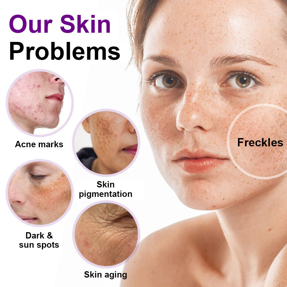 ✅𝐅𝐃𝐀-𝐀𝐏𝐏𝐑𝐎𝐕𝐄𝐃🌟Cheemex® 𝐒𝐩𝐨𝐭𝐄𝐫𝐚𝐬𝐞 𝐏𝐫𝐨𝐛𝐢𝐨𝐭𝐢𝐜 𝐒𝐡𝐢𝐞𝐥𝐝 𝐒𝐞𝐫𝐮𝐦 – Fades Dark Spots, Evens Skin Tone & Boosts Radiance✨